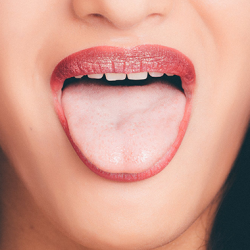 舌苔厚白是怎么回事？竟然隐藏着这样的健康隐患！